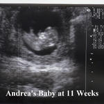 Andrea_s Baby at 11 weeks