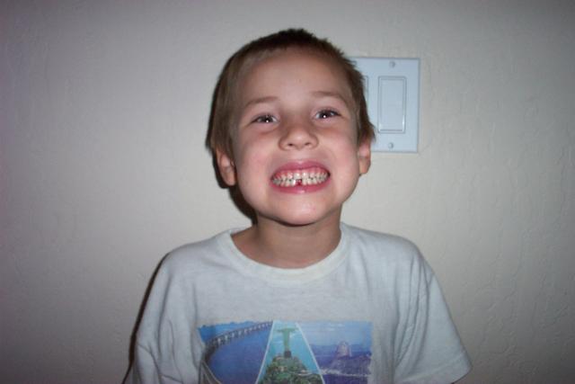Dareks first tooth 001